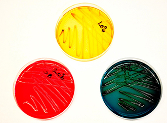 Differential media Â is used for the isolation and differentiation of enteric pathogens. Pictured above is a positive Salmonella culture on Salmonella/Shigella agar (SS), Hektoen agar (HE) andÂ  Xylose Lysine deoxycholate agar (XLD).