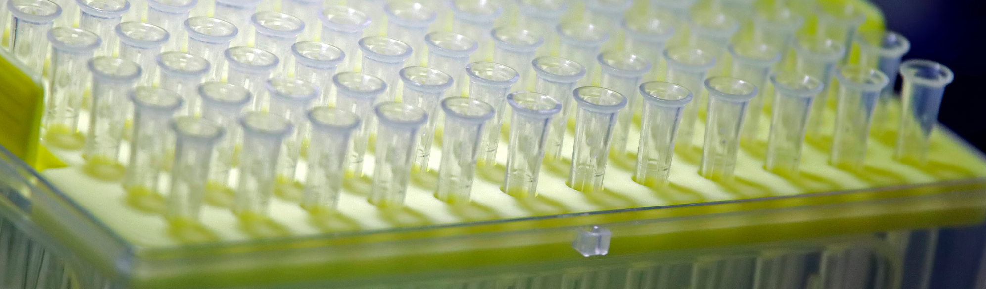 Photo: test tubes in a medical laboratory