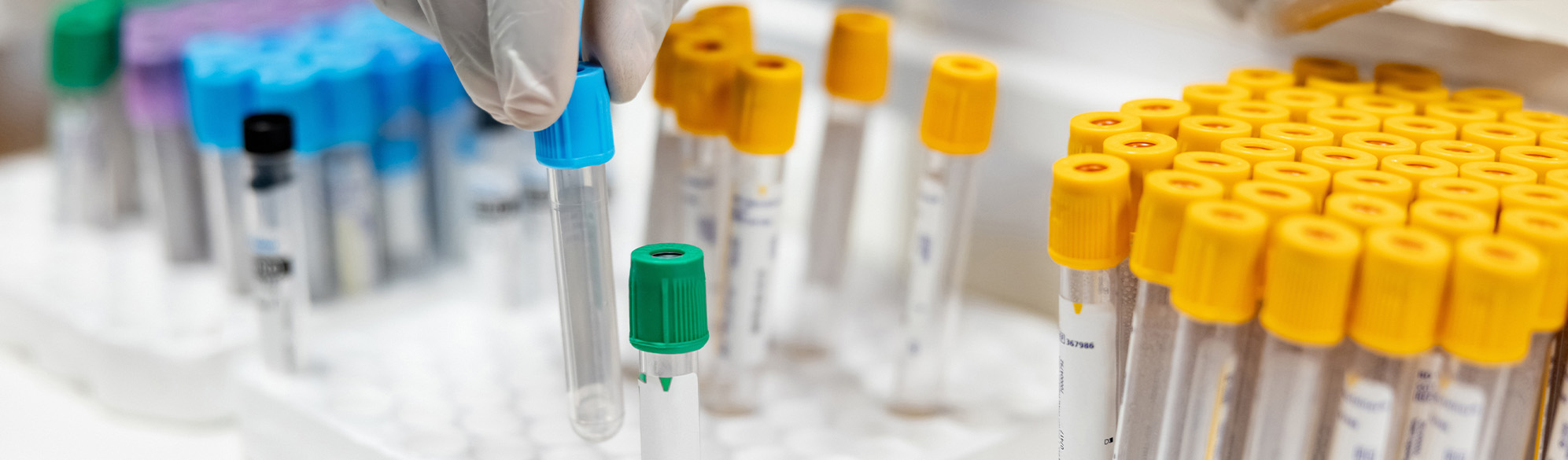Photo: test tubes in a medical laboratory