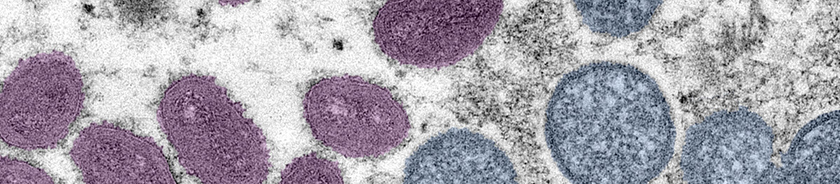 Microscopic image of mpox cells
