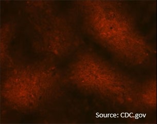 Negative Rabies dFA image (immunohistochemistry microscope image, black background with dull red fluorescent staining)