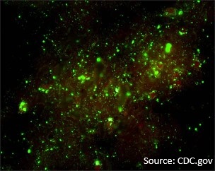 Positive Rabies dFA image (immunohistochemistry microscope image, black background with dull red staining overlaid with bright green fluorescent spots)